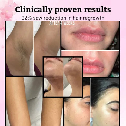 Cyperus Rotundus Oil